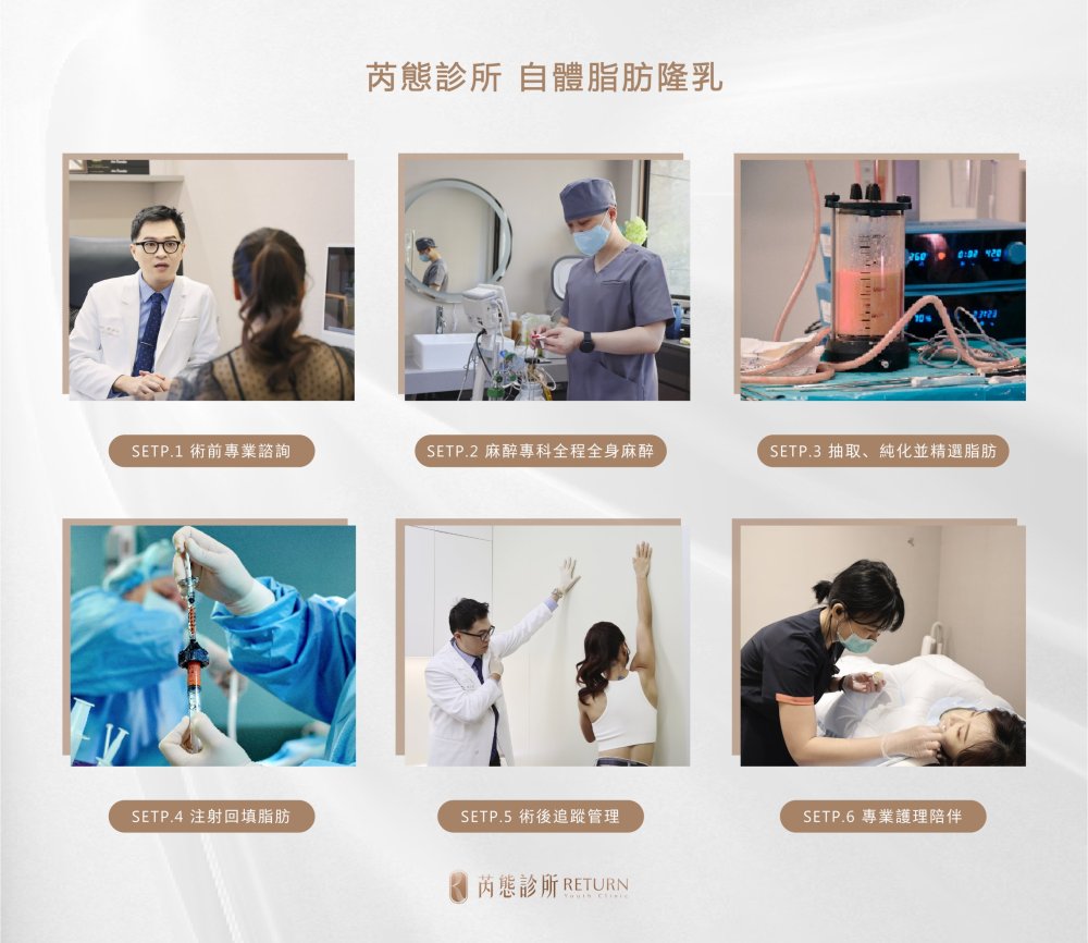 自體脂肪隆乳手術流程圖