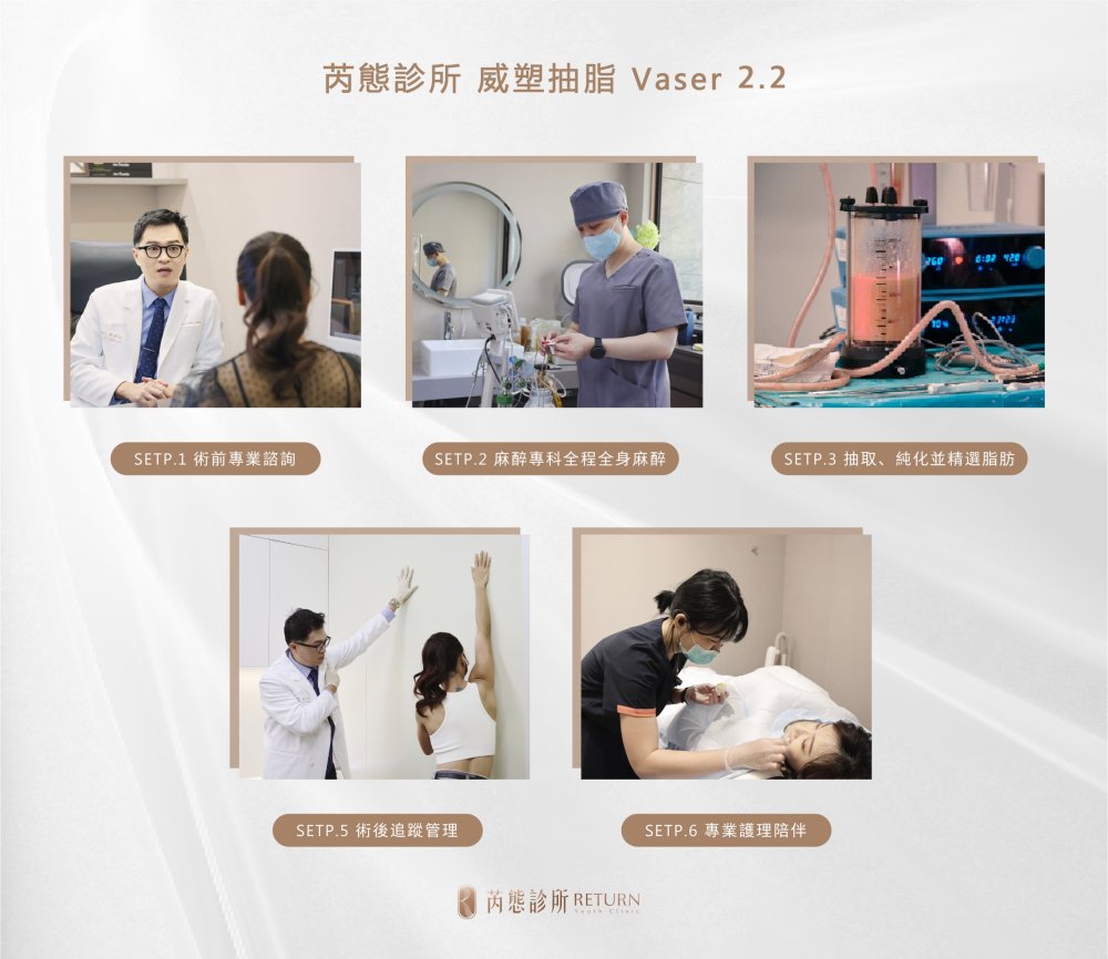 威塑 Vaser2.2 手術流程圖