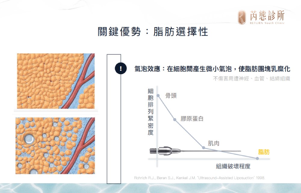 僅針對脂肪細胞乳糜化，保護周遭組織，保留肌膚彈性。