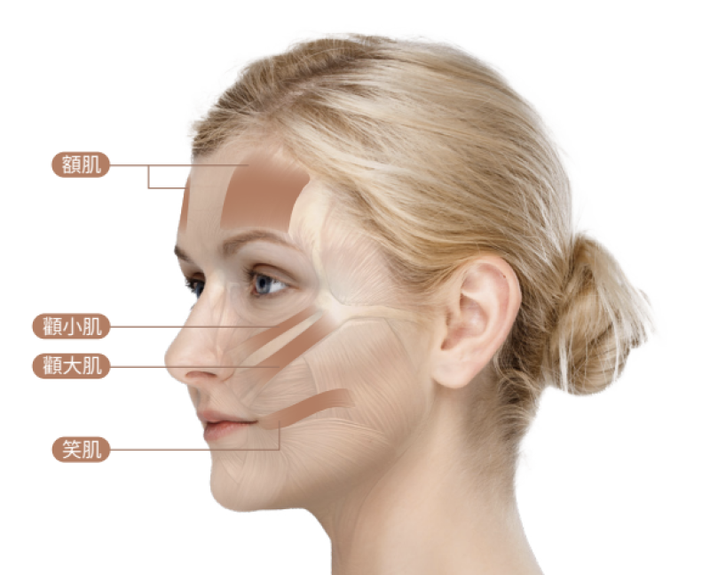 EMFACE-4